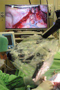 Közép-Európában egyedülálló hallássegítő műtét válik elérhetővé a Szegedi Tudományegyetem fül-orr-gégészeti és fej-nyaksebészeti klinikáján.