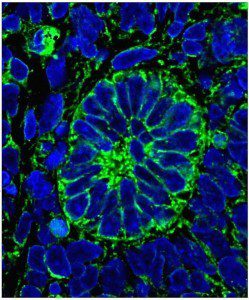 Először hoztak létre működő, vagyis vizelettermelésre képes emberi veseszövetet élő szervezetben kutatók.