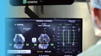 Robotsebészet az ortopédiában: így segítik a digitális rendszerek a térd- és csípőprotézis pontos beültetését