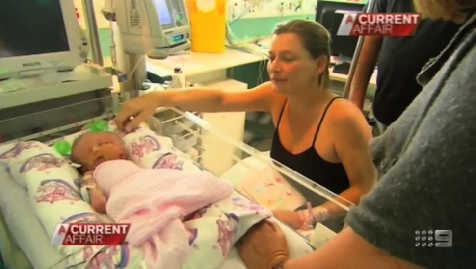 Egy ausztrál édesanya nem mindennapi sziámi ikerpárnak adott életet, ugyanis a csöppségek két arccal, két aggyal, azonban egy testbe zárva jöttek a világra.