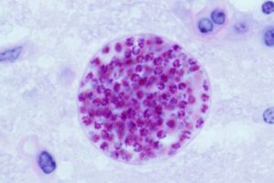 Toxoplasma_gondii - Macskaürülékből rák ellenszer
