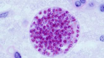 Toxoplasma_gondii - Macskaürülékből rák ellenszer