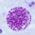 Toxoplasma_gondii - Macskaürülékből rák ellenszer