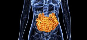 Mi is az a Crohn-betegség? II.