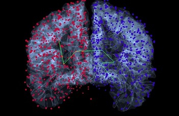 Az ELTE kutatói azonosították agyunk gyakori részgráfjait