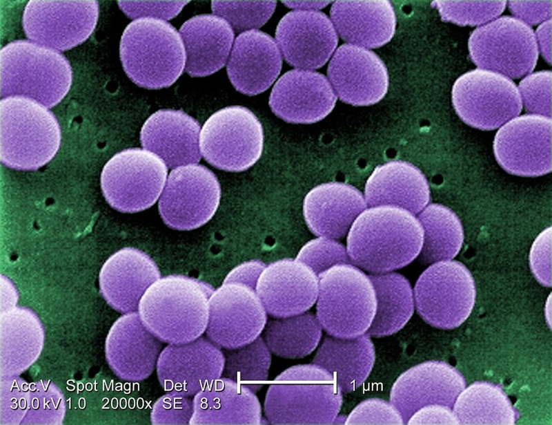 Staphylococcus aureus – gyószer a szuperbaktérium ellen