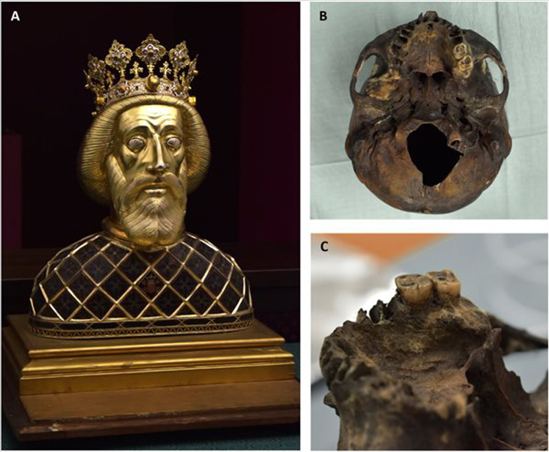 Szent László genomját biztos pontként használva tisztázódott az eddig megtalált királyi maradványok személyazonossága is